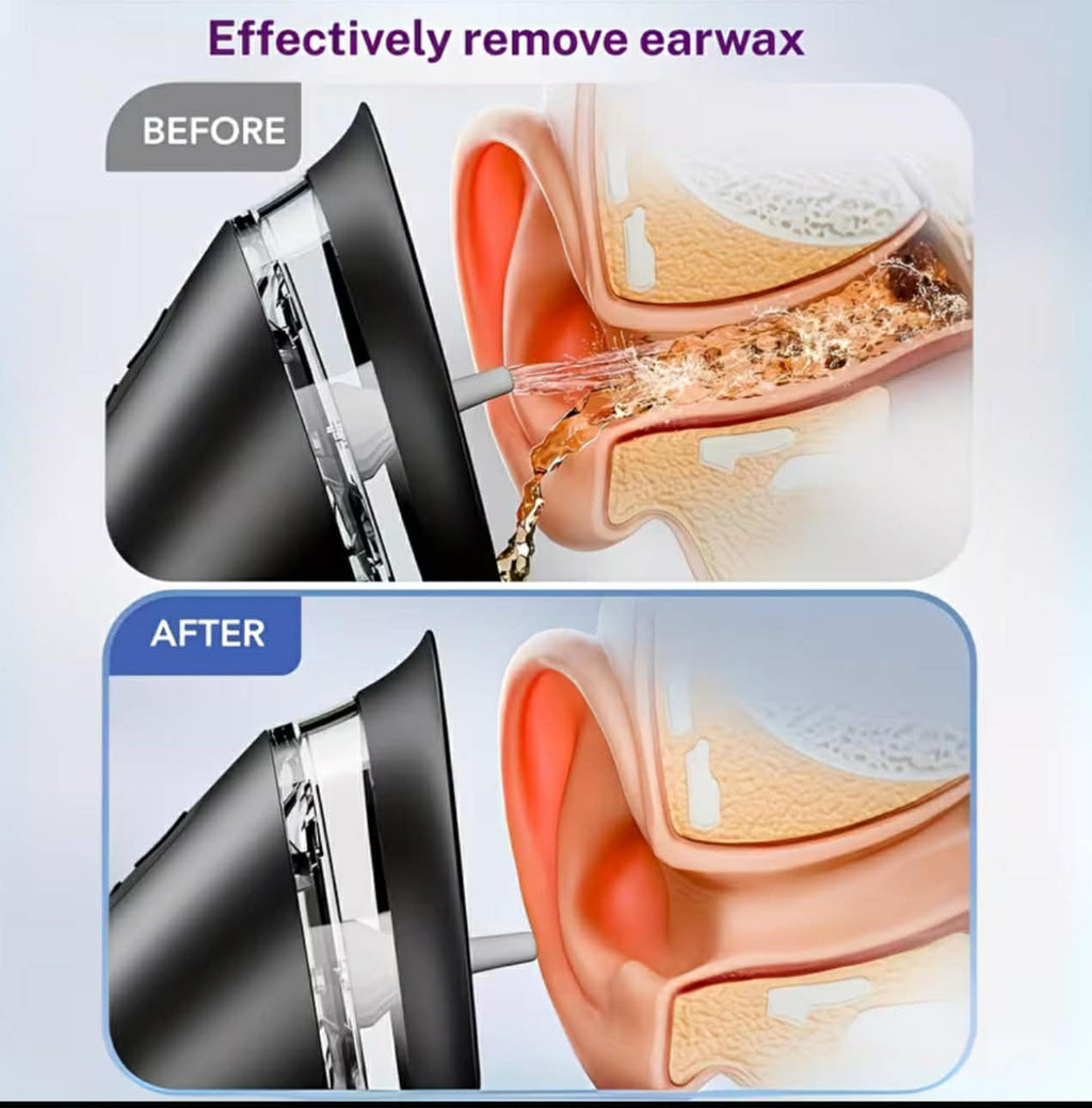 Elektrischer Ohrreiniger – Sanfte & effektive Reinigung